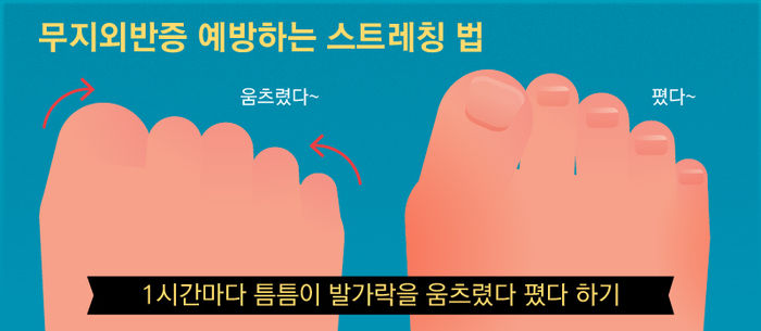 여름철 필수 아이템 '쪼리'…발가락 기형 만드는 주범?