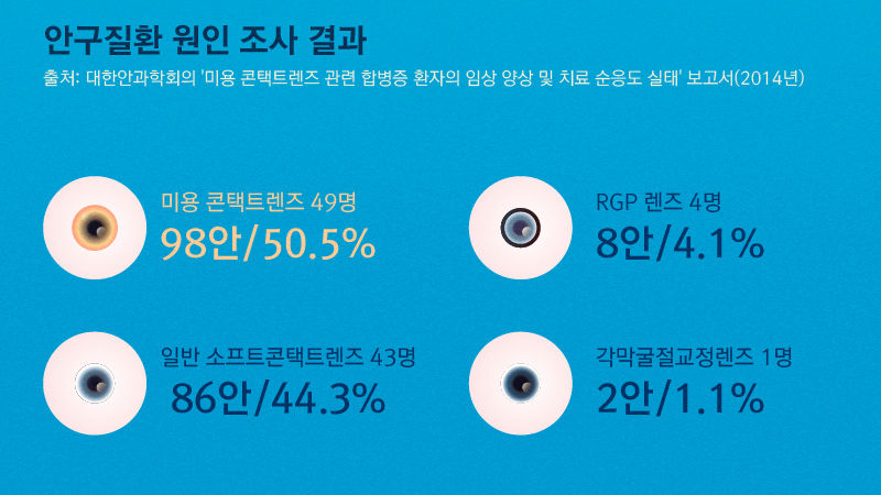 *그래픽
출처: 대한안과학회의 '미용 콘택트렌즈 관련 합병증 환자의 임상 양상 및 치료 순응도 실태' 보고서(2014년)
<안구질환 원인 조사 결과>
미용 콘택트렌즈 49명(98안/50.5%)
일반 소프트콘택트렌즈 43명(86안/44.3%)
RGP 렌즈 4명(8안/4.1%)
각막굴절교정렌즈 1명(2안/1.1%)