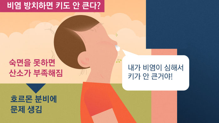 비염 방치하면 키 안큰다?