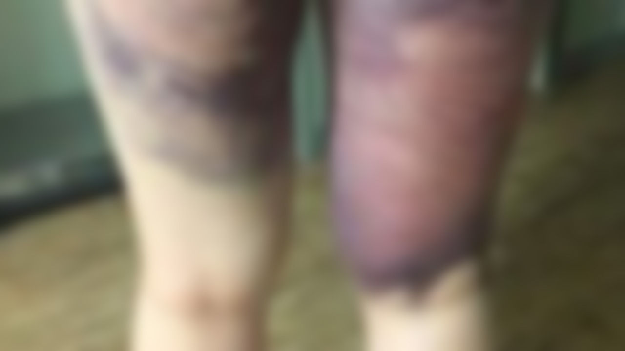 기사 대표 이미지:계명대 체대 후배 폭행 7명 검찰송치…피해자가 가해자로 바뀌어