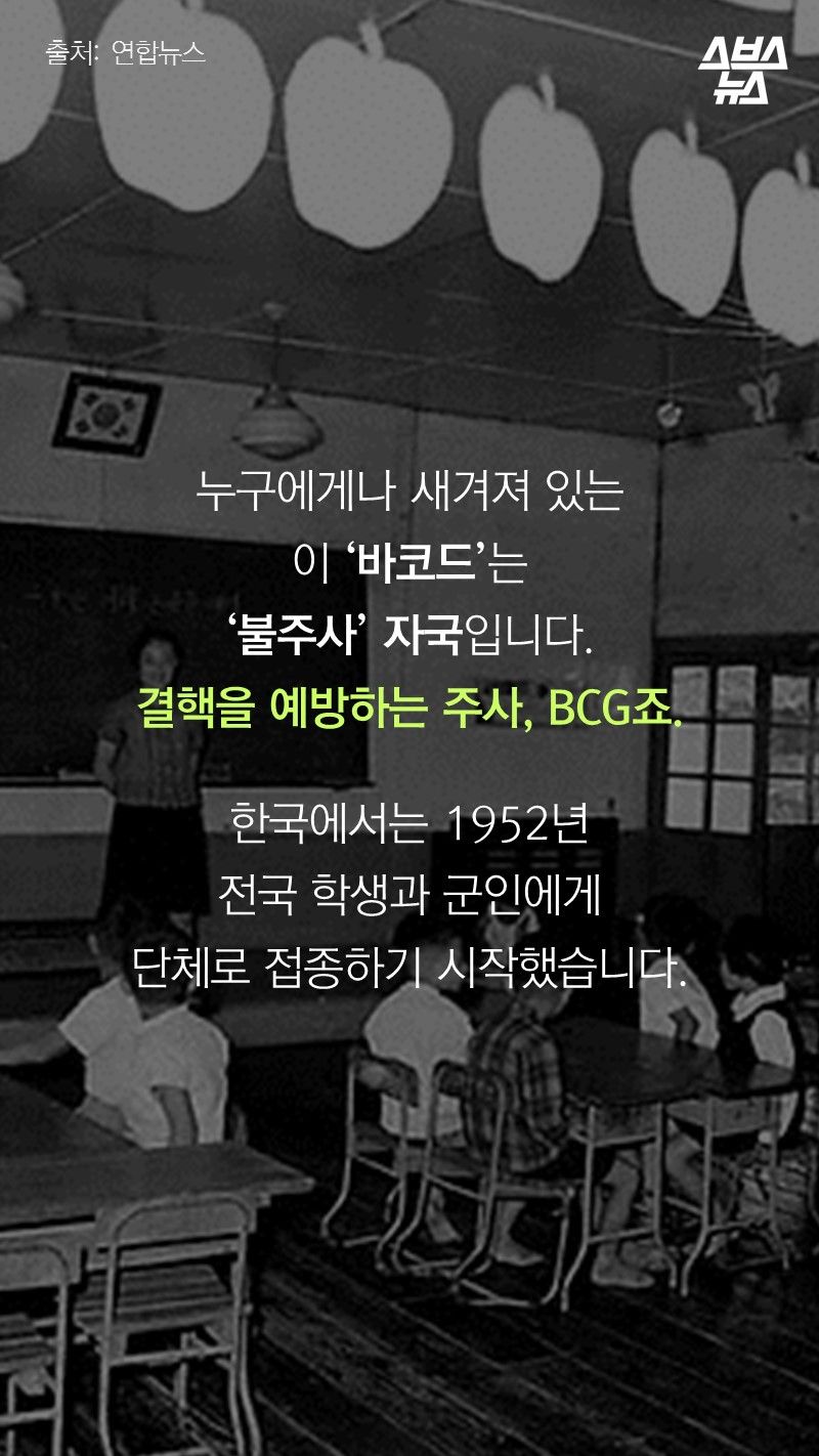 누구에게나 새겨져 있는
이 ‘바코드’는
‘불주사’ 자국입니다.
결핵을 예방하는 주사, BCG죠.
한국에서는 1952년
전국 학생과 군인에게
단체로 접종하기 시작했습니다.