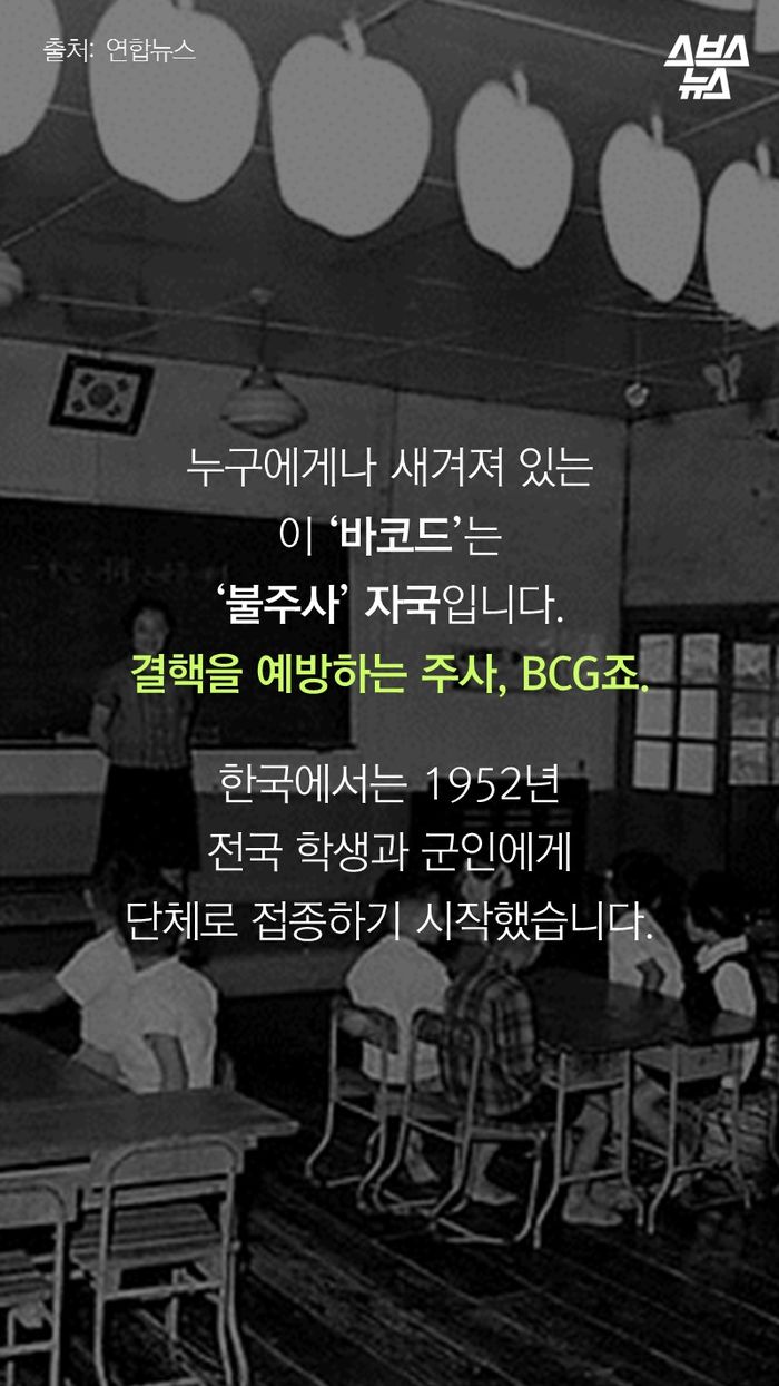 누구에게나 새겨져 있는
이 ‘바코드’는
‘불주사’ 자국입니다.
결핵을 예방하는 주사, BCG죠.
한국에서는 1952년
전국 학생과 군인에게
단체로 접종하기 시작했습니다.