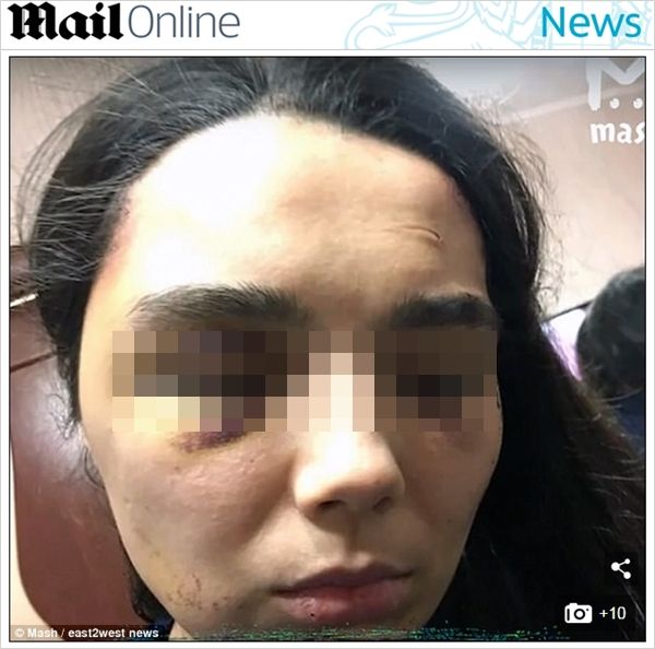 6년 동안 밀실에 갇혀 학대받은 여성