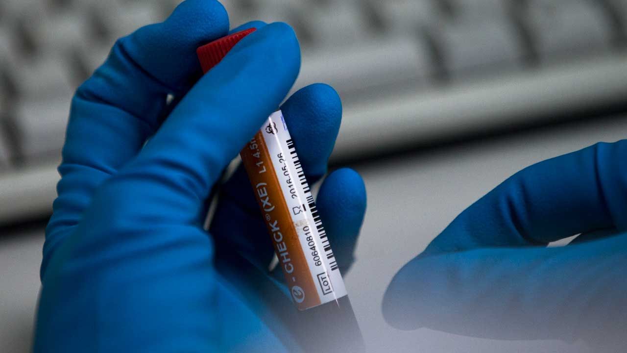 기사 대표 이미지:日 카누선수, 경쟁자 물통에 금지약물 넣었다가 적발