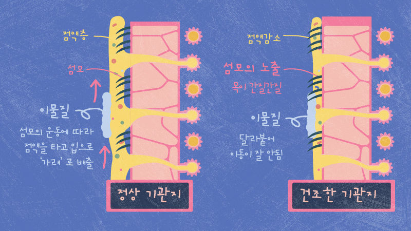 *그래픽
정상 기관지와 건조할 때 기관지 //