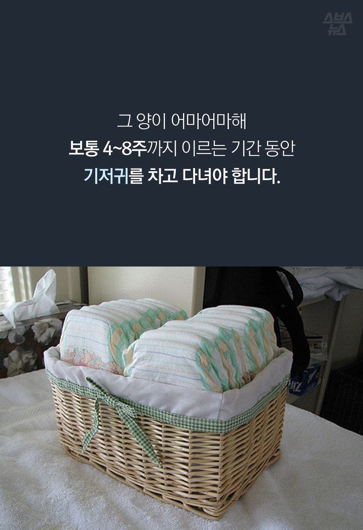 그 양이 어마어마해 
보통 4~8주까지 이르는 기간 동안
기저귀를 차고 다녀야 합니다.