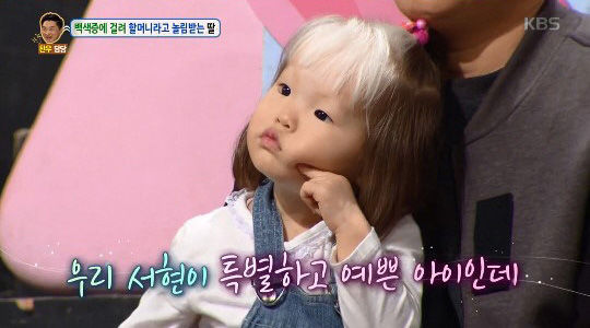 백색증 아이에 대한 편견에 신동엽이 보인 반응