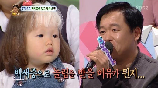 백색증 아이에 대한 편견에 신동엽이 보인 반응
