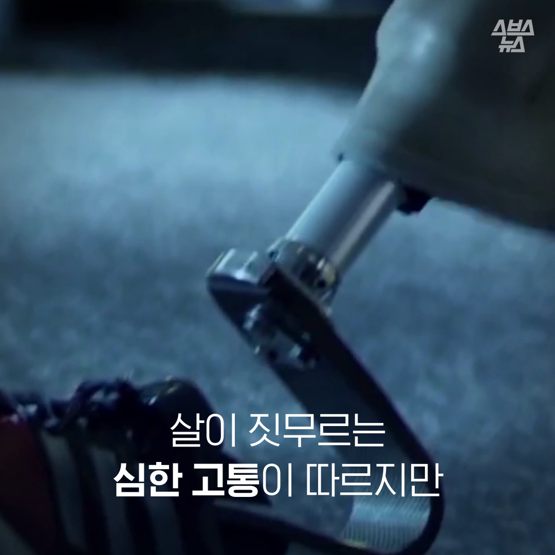 살이 짓무르는 심한 고통이 따르지만