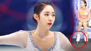 [영상] "최다빈 오른쪽 발목에 저게 뭔가요?"&hellip;열악한 상황에서도 '혼신의 연기'