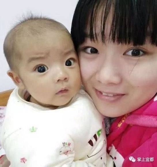 부모 반대 무릅쓰고 아픈 딸에게 간 이식한 엄마의 사연