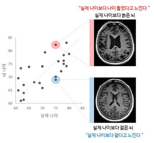 "'나는 젊다'고 느끼는 노인들, 실제 뇌 나이도 젊어"