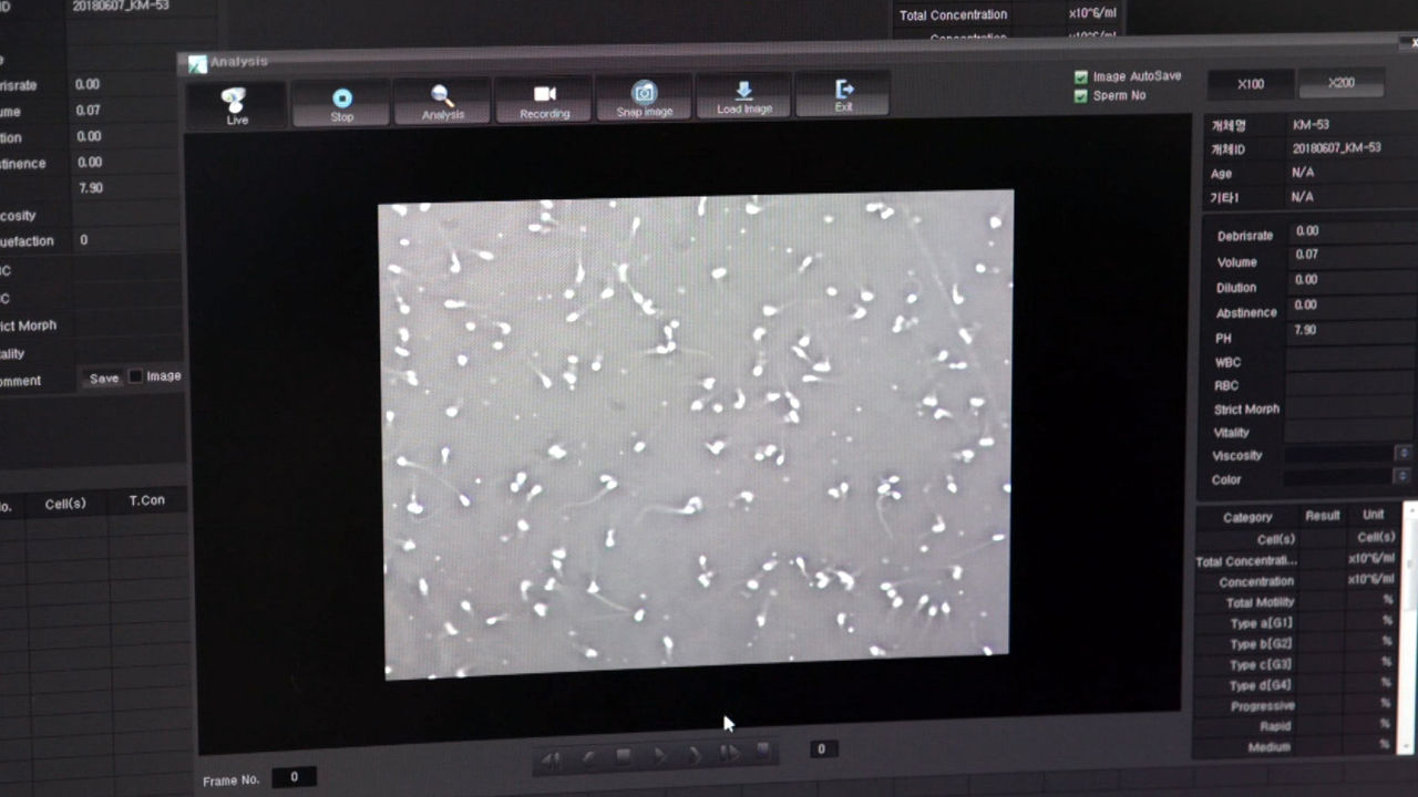 [취재파일] 반달곰 인공수정 첫 출산…다양한 개체복원 길 열어