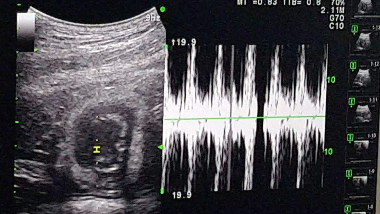 [취재파일] 반달곰 인공수정 첫 출산…다양한 개체복원 길 열어