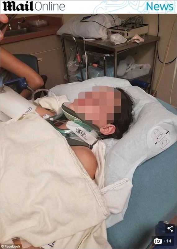 다이빙 준비하는 친구 뒤에서 밀어버린 10대…'위험한 장난'
