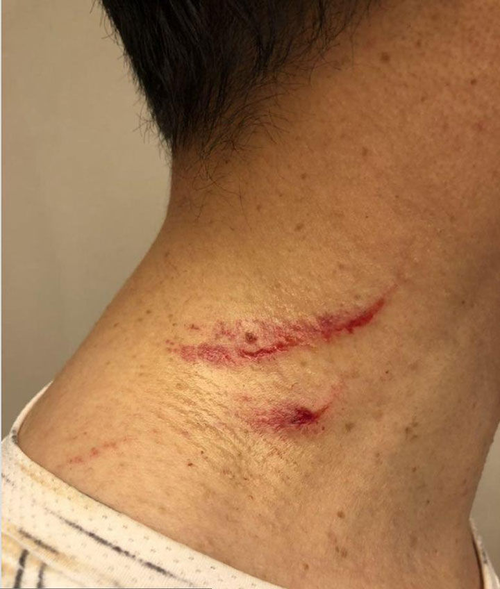 기사 대표 이미지:기동민, 김경수 상처 공개…"백색 테러 단호히 처리해야"
