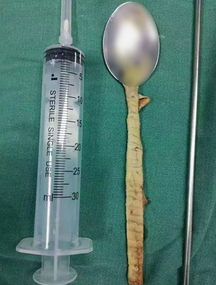 극심한 가슴 통증으로 병원 찾은 남자…밝혀진 황당한 이유