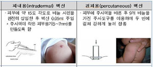 신생아용 결핵백신 (사진=질병관리본부 제공/연합뉴스)