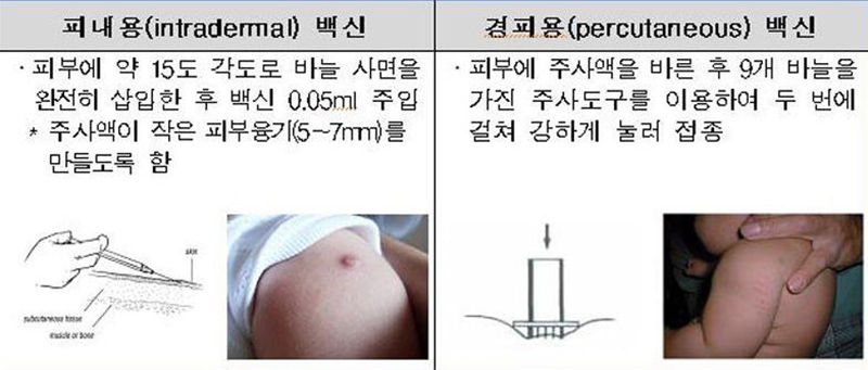 bcg 백신 논란