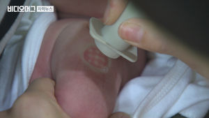 '비소 결핵백신' 석 달 전 알았다&hellip;늑장 공표 '공분'