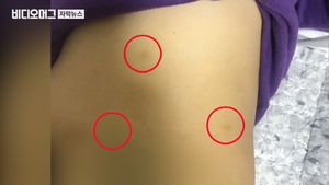 밀고 때리고 꼬집고 "대변도 참아"&hellip;어린이집 학대 정황