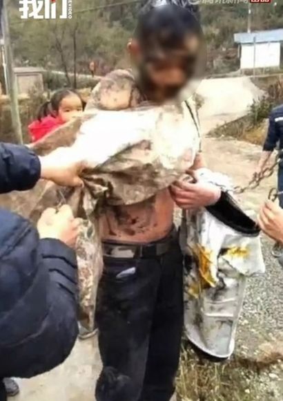 결혼식 날 두개골 골절된 신랑…도 넘은 장난에 친구들 고소