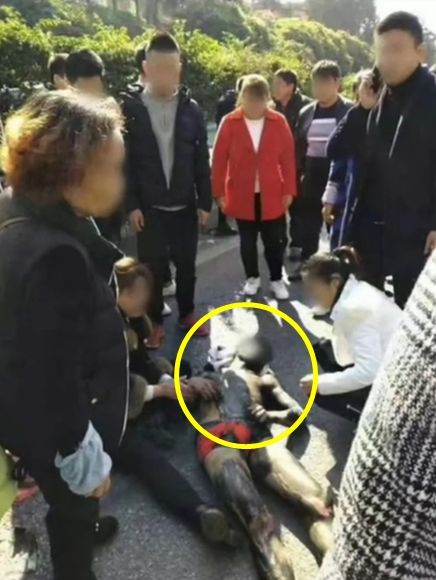 결혼식 날 두개골 골절된 신랑…도 넘은 장난에 친구들 고소