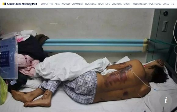 결혼식 날 두개골 골절된 신랑…도 넘은 장난에 친구들 고소