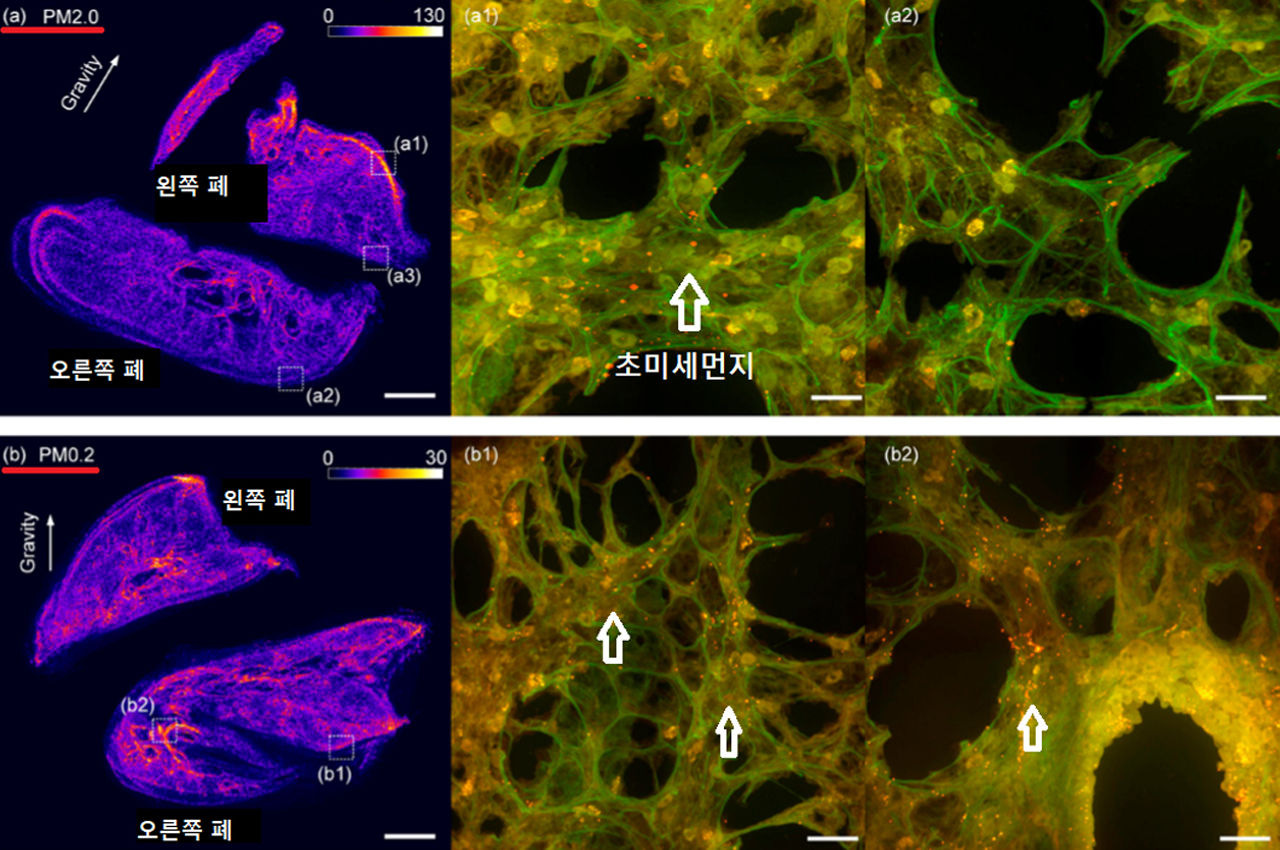 허파꽈리에 쌓인 초미세먼지 분포 (자료: Li et al., 2019)