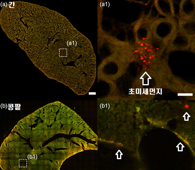 간과 콩팥에 쌓인 초미세먼지 (자료: Li et al., 2019)