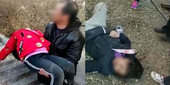불꽃놀이 하다 '맨홀 폭발 사고' 당한 8살 소년