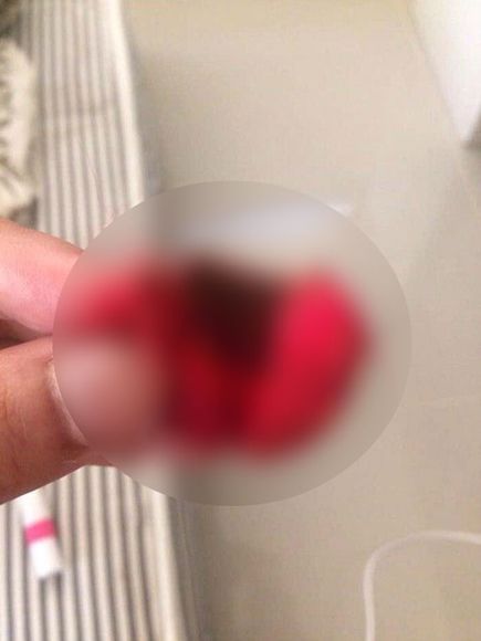 염색했다가 한쪽 귀 잃은 반려견