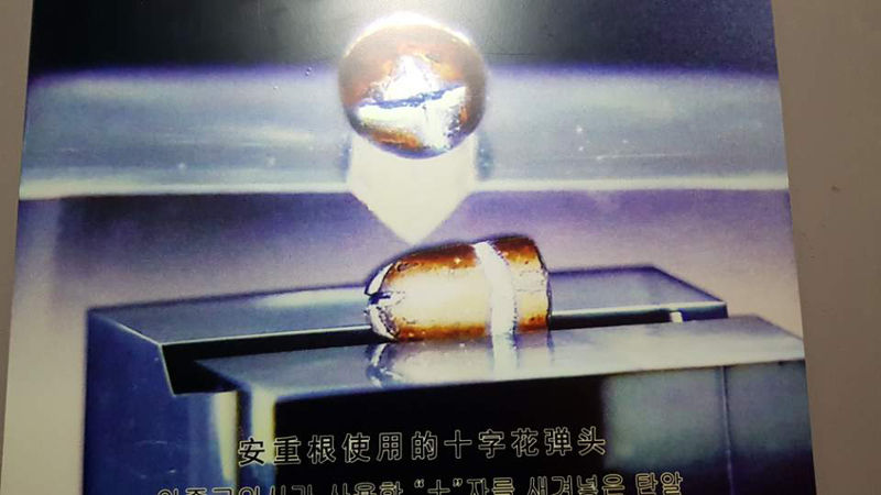 이토 몸에 박힌 총알