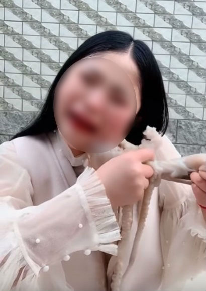 살아있는 문어 먹방 찍으려다 살점 뜯긴 유튜버
