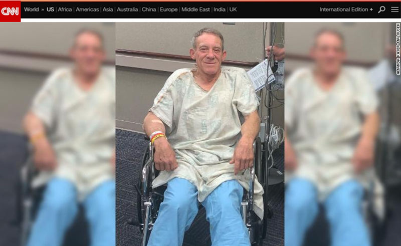 농기계에 낀 다리 스스로 절단해 목숨 건진 남성(사진=CNN 홈페이지 캡처)