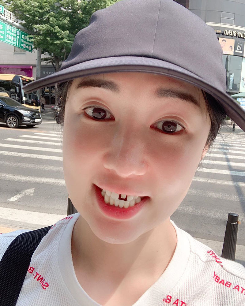 앞니 없는 사유리 근황
