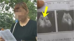 중절 수술에도 살아남은 태아?&hellip;병원 실수로 두 번 눈물 흘린 엄마