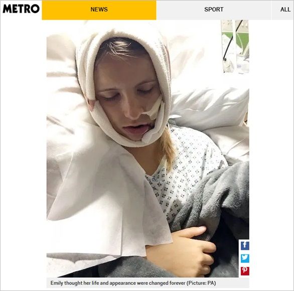 두 동강 난 아래턱…낙마사고 당한 15살 소녀의 기적 같은 회복