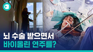 두개골이 절개된 채 바이올린 연주&hellip;'세상에서 가장 간절한 선율'