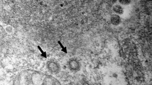 코로나바이러스 입자 크기: 80-100nm (사진=질병관리본부 제공, 연합뉴스)