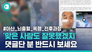 뇌출혈 올 때까지 사람 때리고 "술 취해서 기억 안 난다"