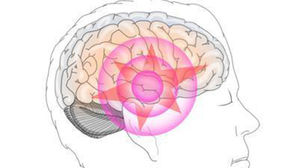 외상후 스트레스 장애(PTSD) (사진=삼성서울병원, 연합뉴스)