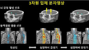 대뇌 감정영역-동맥경화성 염증활성도 삼차원 입체 분자 영상 (사진=고려대 구로병원 제공, 연합뉴스)