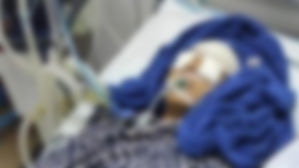 미얀마 쿠데타 항의시위 중 총격받은 여성 '뇌사' (사진=이라와디 웹사이트 캡처, 연합뉴스)