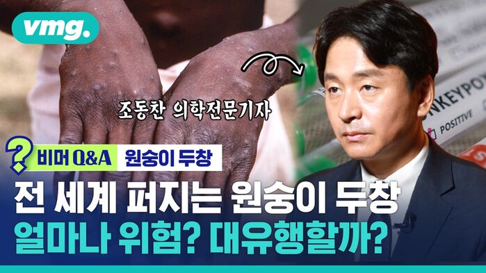 [비머 Q&A] 전 세계 퍼지는 '원숭이 두창'&hellip;얼마나 위험? 대유행할까?
