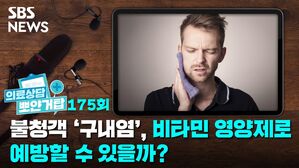 SBS NEWS 의료상담 뽀얀거탑 175회 불청객 '구내염', 비타민 영양제로 예방할 수 있을까?