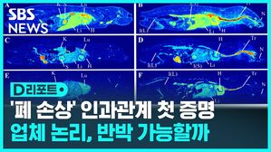 '폐 손상' 인과관계 첫 증명 업체 논리, 반박 가능할까
