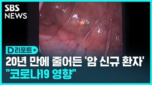 20년 만에 줄어든 암 신규 환자 "코로나19 영향"