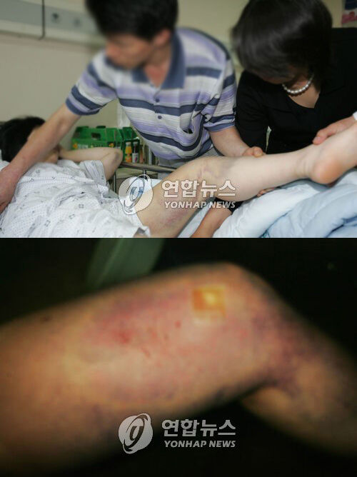 스프 (사진=연합뉴스)
