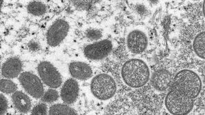 엠폭스(MPOX&middot;옛 명칭 원숭이두창) 바이러스 입자 (사진=AP, 연합뉴스)